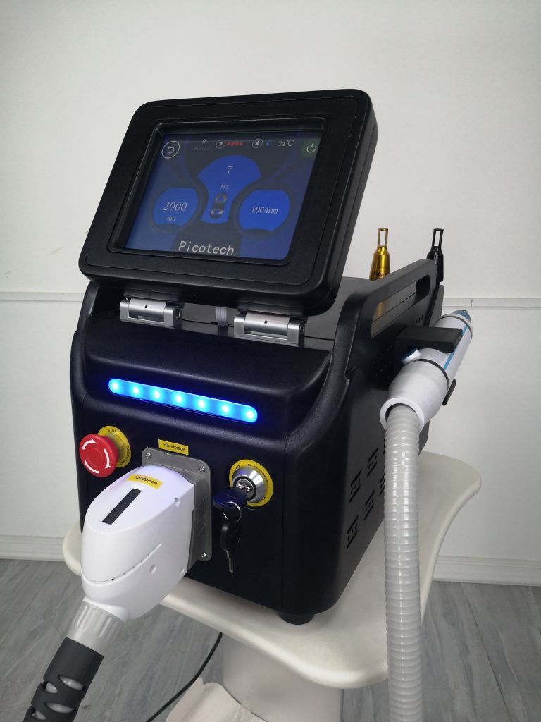 Latest company case about q switch laser tattoo removal factories